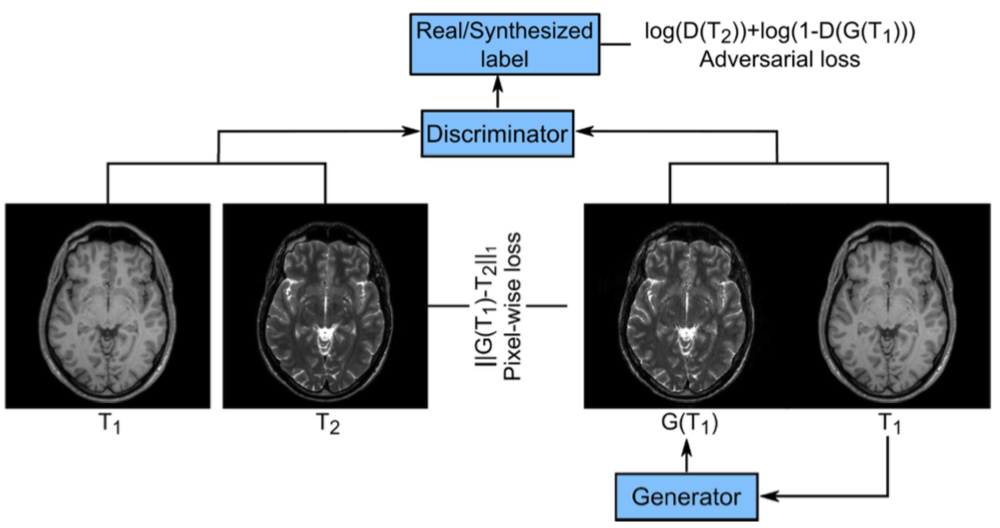 Image Synthesis in Multi-Contrast MRI with Conditional Generative Adversarial Networks